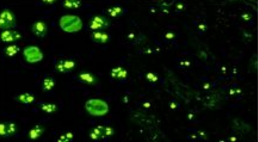 Cy5.5标记人转铁蛋白(TF-Cy5.5) Cy5.5标记人转铁蛋白(TF-Cy5.5)