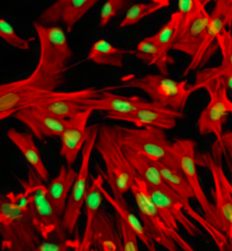葡萄糖-四甲基罗丹明 葡萄糖-四甲基罗丹明